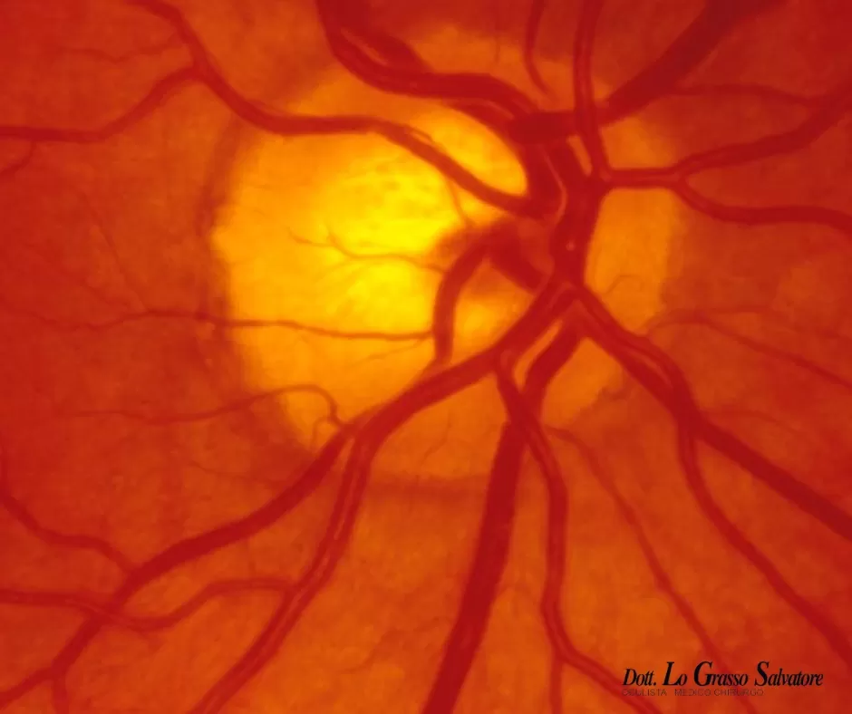 Fondo fundus